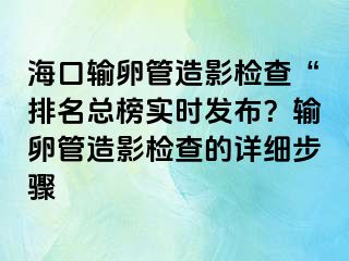 海口輸卵管造影檢查“排名總榜實時發(fā)布？輸卵管造影檢查的詳細(xì)步驟