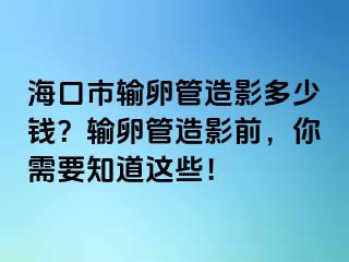 ?？谑休斅压茉煊岸嗌馘X？輸卵管造影前，你需要知道這些！